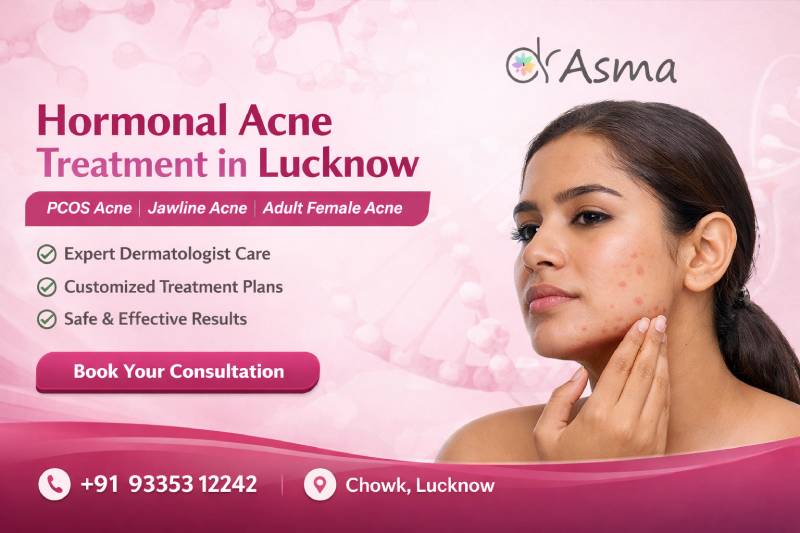 Hormonal Acne Treatment: Managing PCOS Acne, Jawline Acne & Adult Female Acne