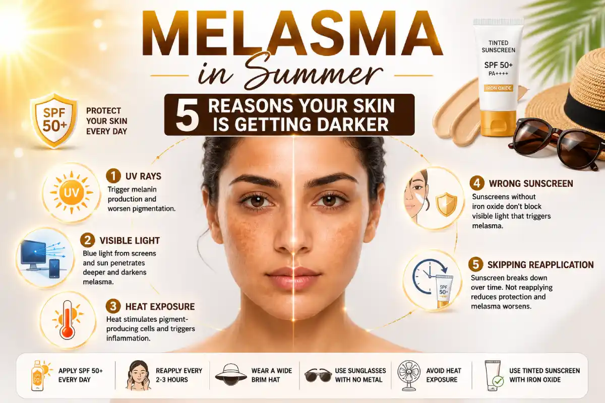 Melasma in summer_ 5 key triggers